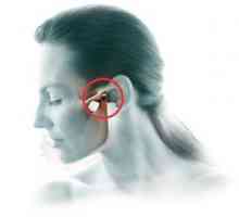 Artritída maxilofaciálneho kĺbu: príznaky a liečba