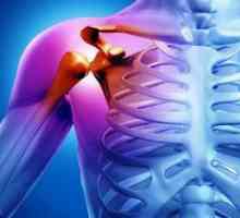 Artritída ramenného kĺbu: príznaky a liečba