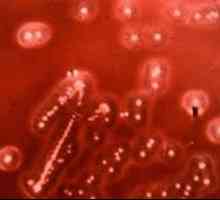 Streptococcus viridans baktérií (streptococcus viridans)