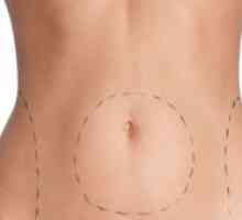 Neoperurgická liposukcia: technika, komplikácie, recenzie