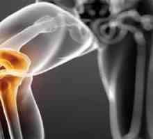 Ochorenie húf kolenného kĺbu: diagnostika a liečba