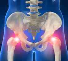 Hip kyčelného kĺbu: prečo sa dáva do nohy