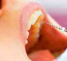 Je bolestivé odstrániť nerv z zuba?