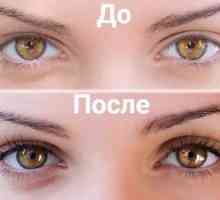 Rôzne riasy Botox: indikácie pre vedenie