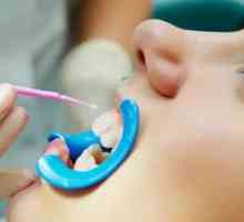 Čo je užitočné pri fluorácii zubov?