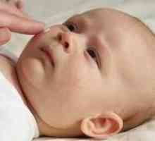 Čo potrebujete vedieť o toxickom erytému u novorodencov