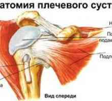 Čo je plexitída ramenného kĺbu, príznaky a liečba