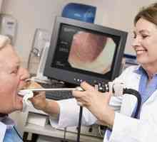 Aká je priama a nepriama laryngoskopia hrtana