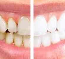 Čo je hygienické čistenie zubov?
