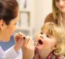 Čo je gn - hypertrofia palatinových mandlí u dieťaťa
