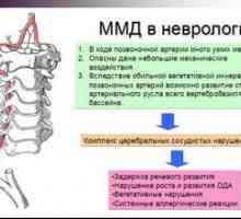 Diagnóza neurologa mmd (minimálna dysfunkcia mozgu)