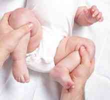 Bolestivá dysplázia u dojčiat