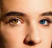 Heterochromia u ľudí - príčiny vzhľadu, ako sa úmyselne dostať do choroby