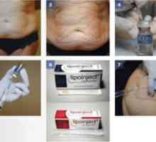 Lipolické injekcie - injekcie na spaľovanie tukov na zníženie hmotnosti