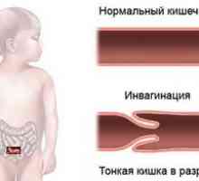 Invázia čreva u dieťaťa - čo to je?