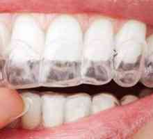 Eleneers pre zarovnanie zubov: typy a popis