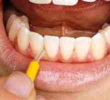 Štetec na čistenie zubov: čo by malo byť štetcom pre zuby?