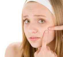 Ako sa zbaviť akné na tvári adolescentov