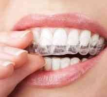 Ako správne vyrovnať a narovnať svoje zuby doma
