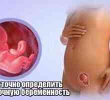 Ako určiť mimomaternicové tehotenstvo