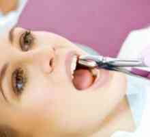 Ako zastaviť krv po extrakcii zubov