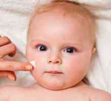 Ako vyzerá dermatitída dieťaťa a jeho druhu?