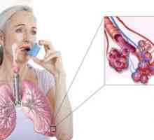 Ako vyliečiť astmu: môžem sa zbaviť navždy doma