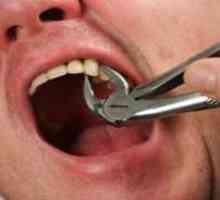 Ako roztrhnúť zub bez bolesti a strachu