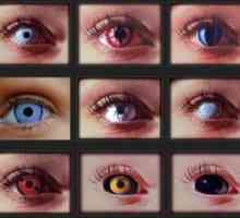 Aké sú typy kontaktných šošoviek pre oči