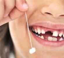 Aké detské zuby sa v dieťati menia na trvalé
