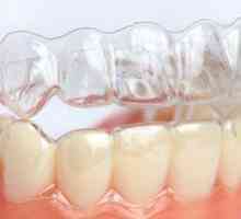 Kapy na bielenie zubov doma