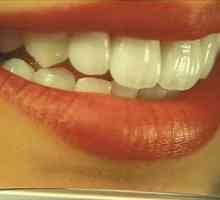 Keramické zuby: aké sú výhody keramických koruniek