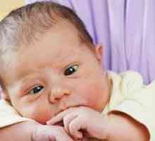 Kedy sa má u novorodencov vyskytnúť strabizmus