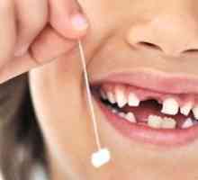 Kedy deti majú detské zuby?