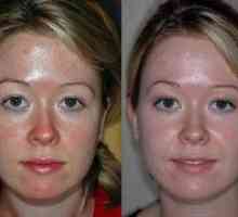 Kozmetická masáž tváre: stojí za to vyskúšať?