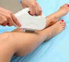Laserová epilácia nohy: opis a náklady