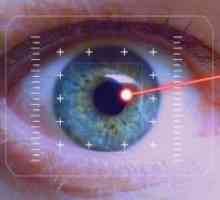 Korekcia zraku laserom: následky a recenzie