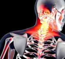 Liečba artropózy krčnej chrbtice