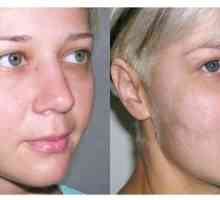 Zmršťovací krém - najlepší prostriedok na pokožku tváre s účinkom výstuh
