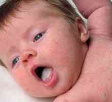 Draslík v ústach dieťaťa: príčiny liečby