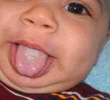 Draslík v ústach dieťaťa: príznaky a liečba