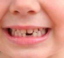 Baby zuby: v akom veku začnú vypadávať?