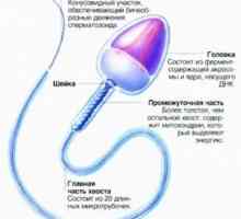 Morfológia spermogramu: anomálie a dekódovanie spermií