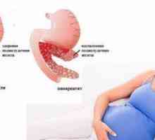 Môžem piť pankreatín počas tehotenstva?