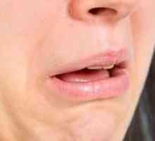 Nepríjemná chuť v ústach: príčiny, symptómy a liečba