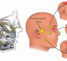 Neuritida trojklaného nervu: príznaky a liečba
