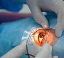 Operácia na výmenu objektívu oka