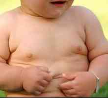 Obezita u detí: príznaky a liečba
