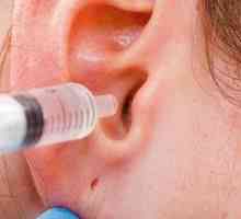 Peroxid vodíka pre uši: samočistiť síru v uchu