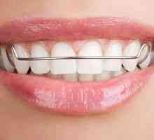 Dosky na zoradenie zubov: ortodontická platňa